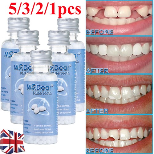 30g tooth repair - tooth,